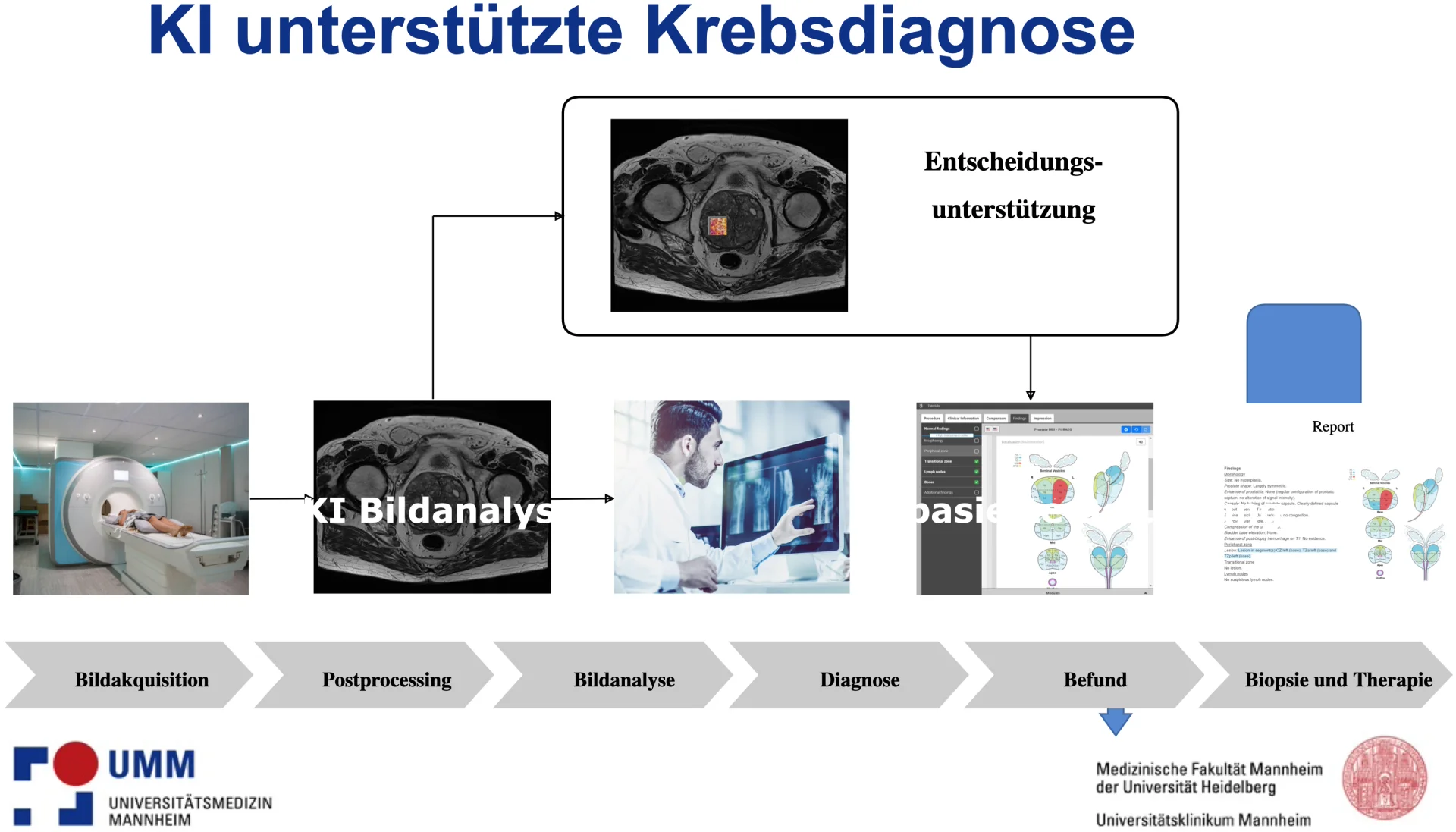 Prozess der KI-unterstützten Diagnose und Therapie onkologischer Patienten